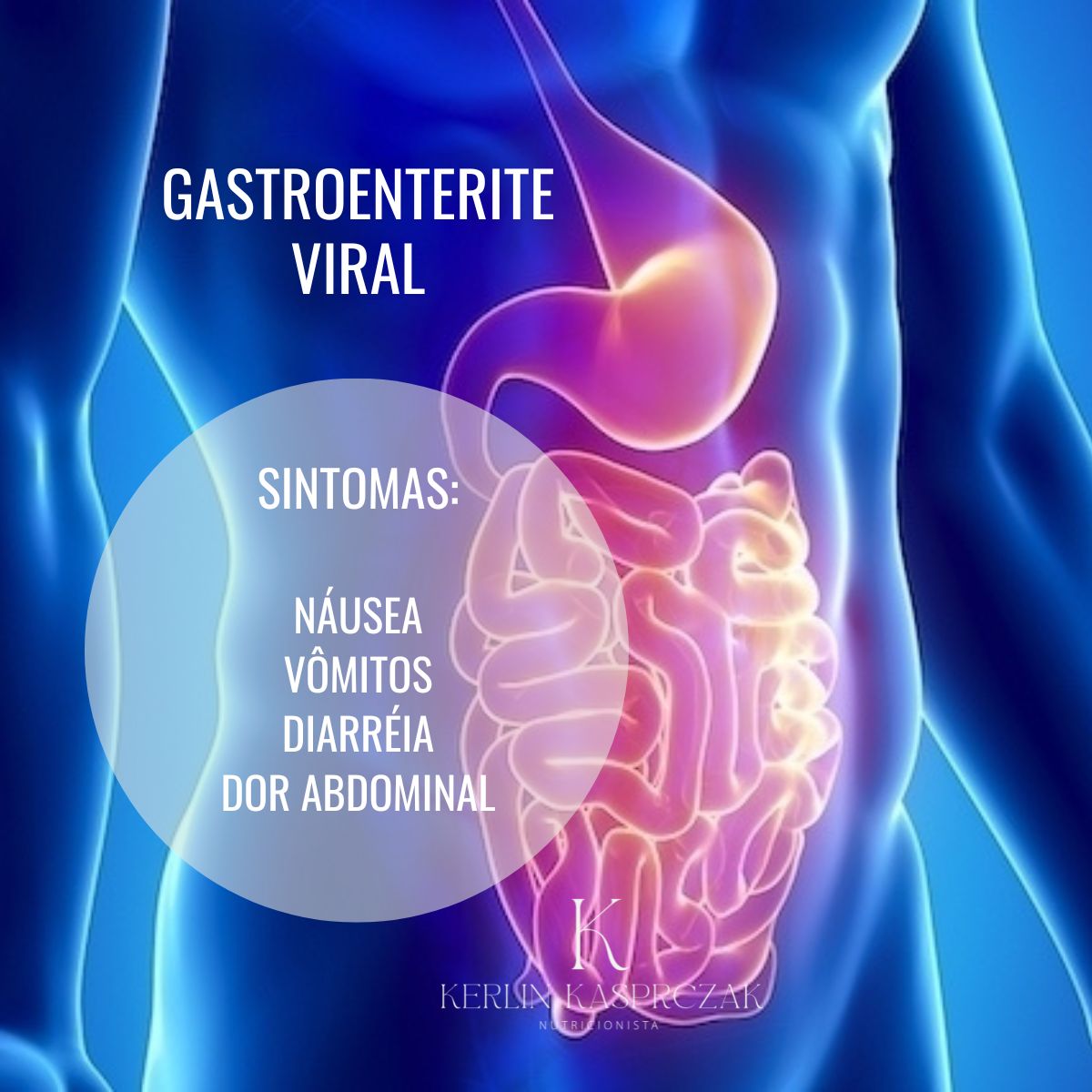 Gastroenterite Viral